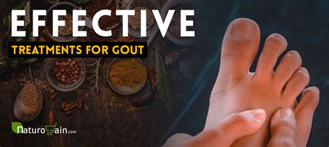 Gout Natural Treatment 8 Effective Treatments For Gout Symptoms Relief