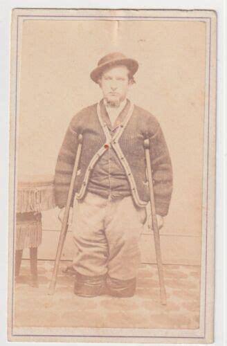 Civil War Soldier Double Leg Amputee On Crutches 1860s Union