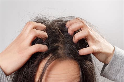 Sensitive Scalp Causes And Treatment Options