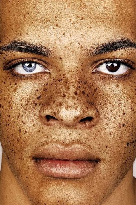 These Portraits Celebrate The Joy Of Having Freckles Black Is Beautiful Beautiful Eyes