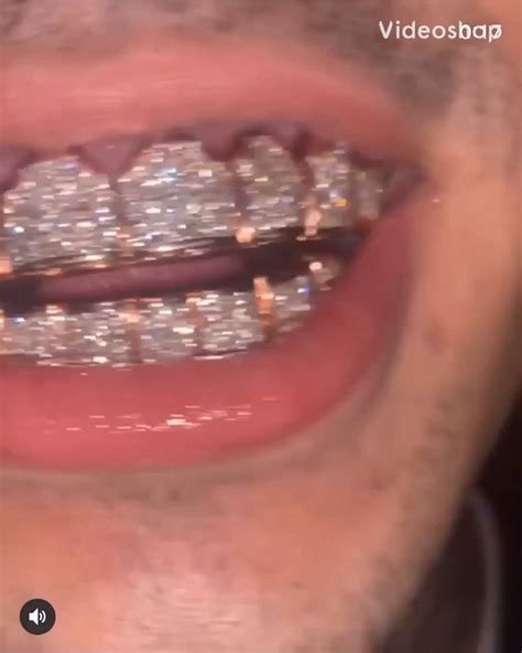 Do You Really Want To Overpay Video Teeth Jewelry Grills Teeth