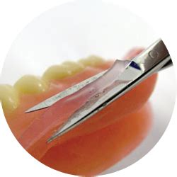 Many patients find it easier to adjust to a denture when it is fitted with a soft liner. Home - Woodside Denture Centre
