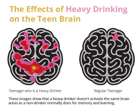 Effects Of Alcohol On The Body And Brain Rehab Guide