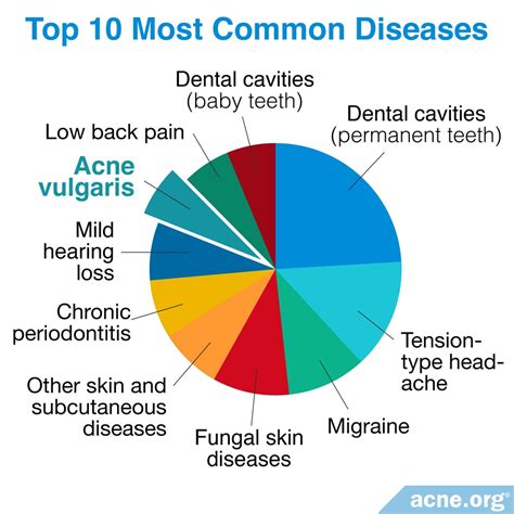 Is Acne A Disease