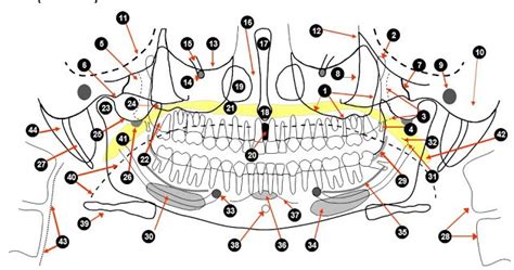 Tecnicos Radiologos Ortopantomografia Radiografia Dental Panorámica