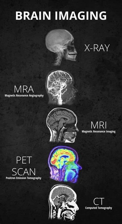 Different Types Of Brain Imaging And What It Looks Like Medical