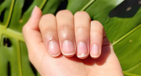 The White Spots On Your Nails What They Mean And How To Solve Them