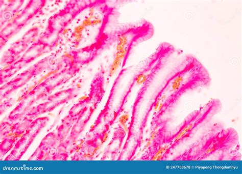 Tissue Of Stomach Human Under The Microscope In Lab Stock Photo