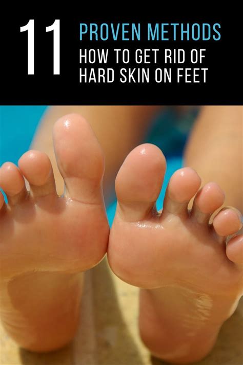 Knowing How To Get Rid Of Hard Skin On Feet Is One Thing But Doing It Correctly To Make Sure