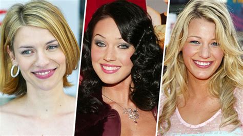 Celebrity Plastic Surgery 30 Before And After Pics