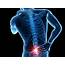 Lower Back Pain  Dr Michael A Castillo MD