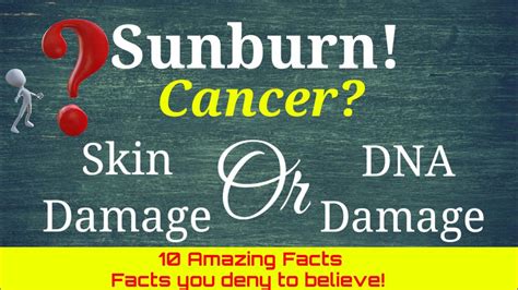 Sunburn Cancer 10 Amazing Facts Amazing Facts World Amazing