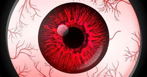 What Causes Bloodshot Eyes Bard Optical
