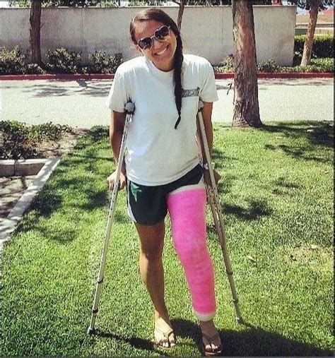 Pin By Join Now On Crutches Leg Cast Long Leg Cast It Cast