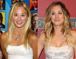 Kaley Cuoco Plastic Surgery Before And After Photos Celeblens