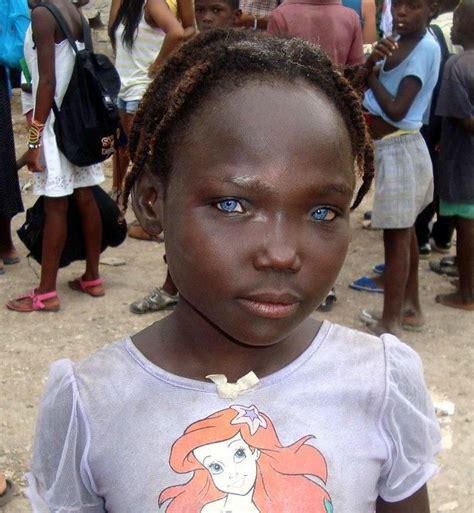 Haitian Blue Eyed Beauty Black With Blue Eyes People With Blue Eyes