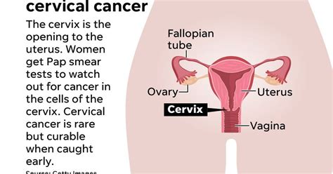 What Do U Do If U Have Cervical Cancer What Does Oral Cancer Look