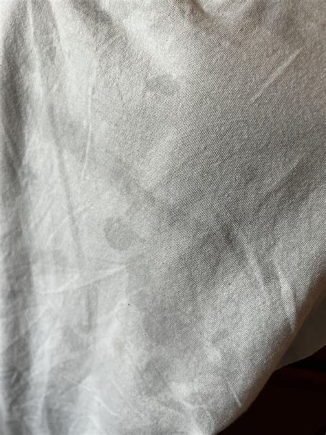 Weird Stains On Clothes After Washing Does Anyone Know What They Could