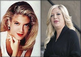 Tori Spelling Celebrities Then And Now Celebrity Plastic Surgery Girl Celebrities