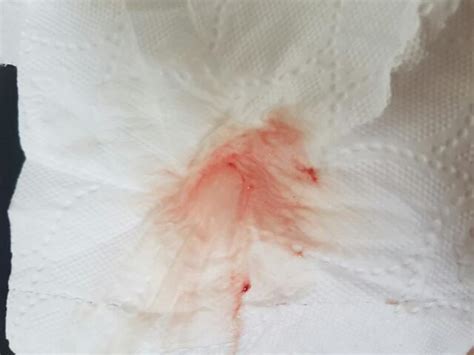At seven weeks pregnant, cartilage is forming in all your baby's limbs, and nerves are spreading through his legs. Implantation bleeding??? TMI!!!! - Glow Community