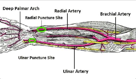 Course Of Ulnar Artery In Forearm And Palmar Blood Flow With Puncture