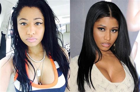 Nicki Minaj Before Plastic Surgery Plastic Surgery Before And After