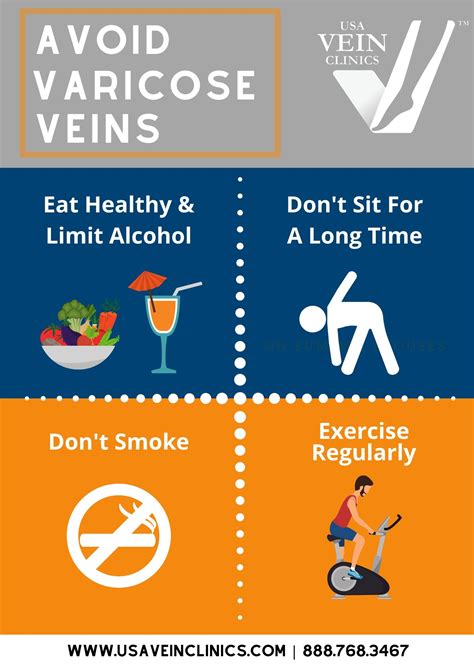 How To Prevent Varicose Veins 6 Effective Methods Usa Vein Clinics