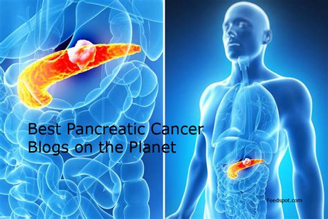 20 Best Pancreatic Cancer Blogs And Websites In 2023