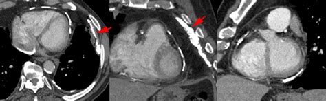 Une fois connecté à votre compte, créez vos cas cliniques et vos chaînes depuis votre espace personnalisé. Scanner pour les calcifications - IRM Cardiaque par ...