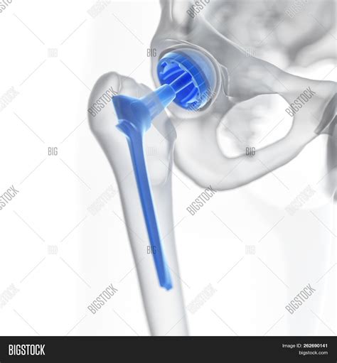 3d Rendered Medically Image And Photo Free Trial Bigstock