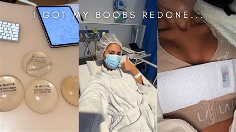 I GOT MY BOOBS DONE AGAIN Breast Revision Surgery Vlog Experience
