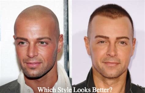 Joey Lawrence Hair Transplant Plastic Surgery Hair Piece And Hair