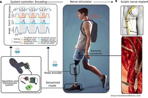 Leg Amputees Feel And Use The Prosthesis As A Real Limb Science Mission