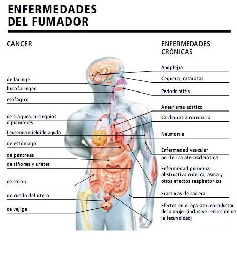 El cuerpo humano.— transcripción de la presentación una gota de sangre contiene unos 5 millones de glóbulos rojos, de a glóbulos blancos y alrededor de plaquetas. 606cf-grafico02a_enfermedadesfumador | Beatriz, Tu ...