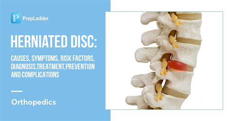 Herniated Disc Causes Symptoms Risk Factors Diagnosis Treatment