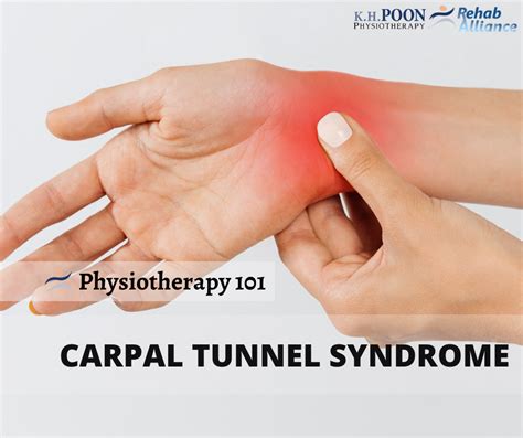 What Is Carpal Tunnel Syndrome Cts Carpal Tunnel Carpal Tunnel My XXX Hot Girl