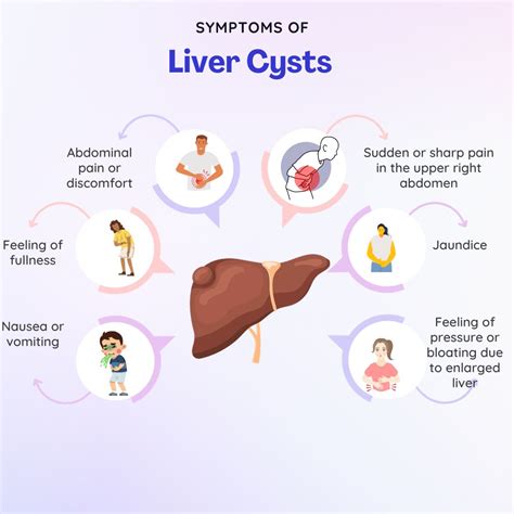 Liver Cyst Causes Risk Factors Symptoms Treatment