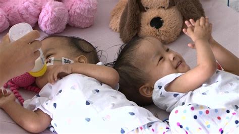 Formerly Conjoined Twins Giggle Together After Successful Separation