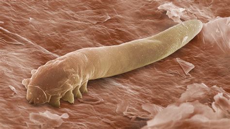 What Is The Microscopic Mite That Lives On The Human Skin Called