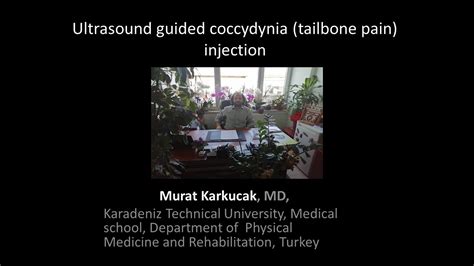 Ultrasound Guided Coccydynia Tailbone Pain Injection By Prof Murat