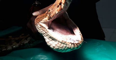 Deadly 12ft Python Gets Double Chin Removed As Vets Operate On
