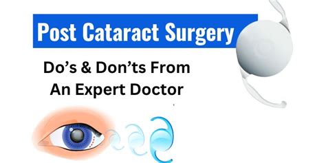 Post Cataract Surgery Dos And Donts From An Expert Doctor Best Eye