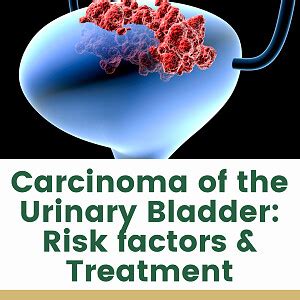 Treatment Options And Risk Factors For Bladder Cancer In H Flickr