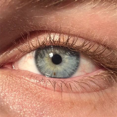 Til That There Is No Blue Pigmentation In Blue Eyes The Eyes Appear