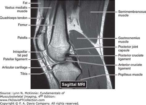 Knee Muscle Anatomy Mri Normal Knee Mri Image