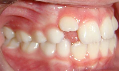 24 Dental Development Platinum Orthodontics