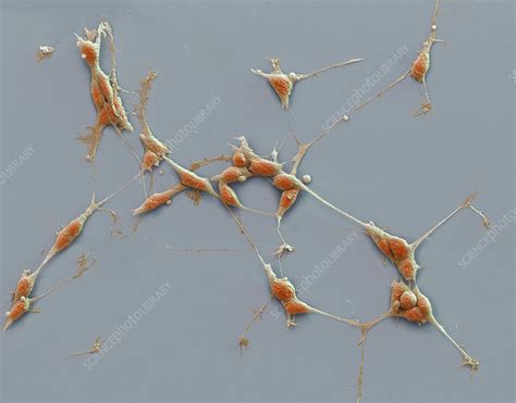 Neuroblastoma Cancer Cells Sem Stock Image C0387105 Science