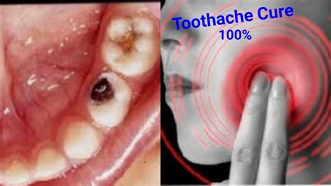 How To Stop Toothache At Night What Can I Use To Get Rid