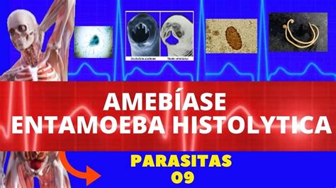 AmebÍase Entamoeba Histolytica Parasitologia Infectologia Youtube