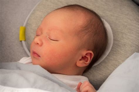 Ini Penyebab Kepala Bayi Peyang Dan Cara Mengatasinya Alodokter